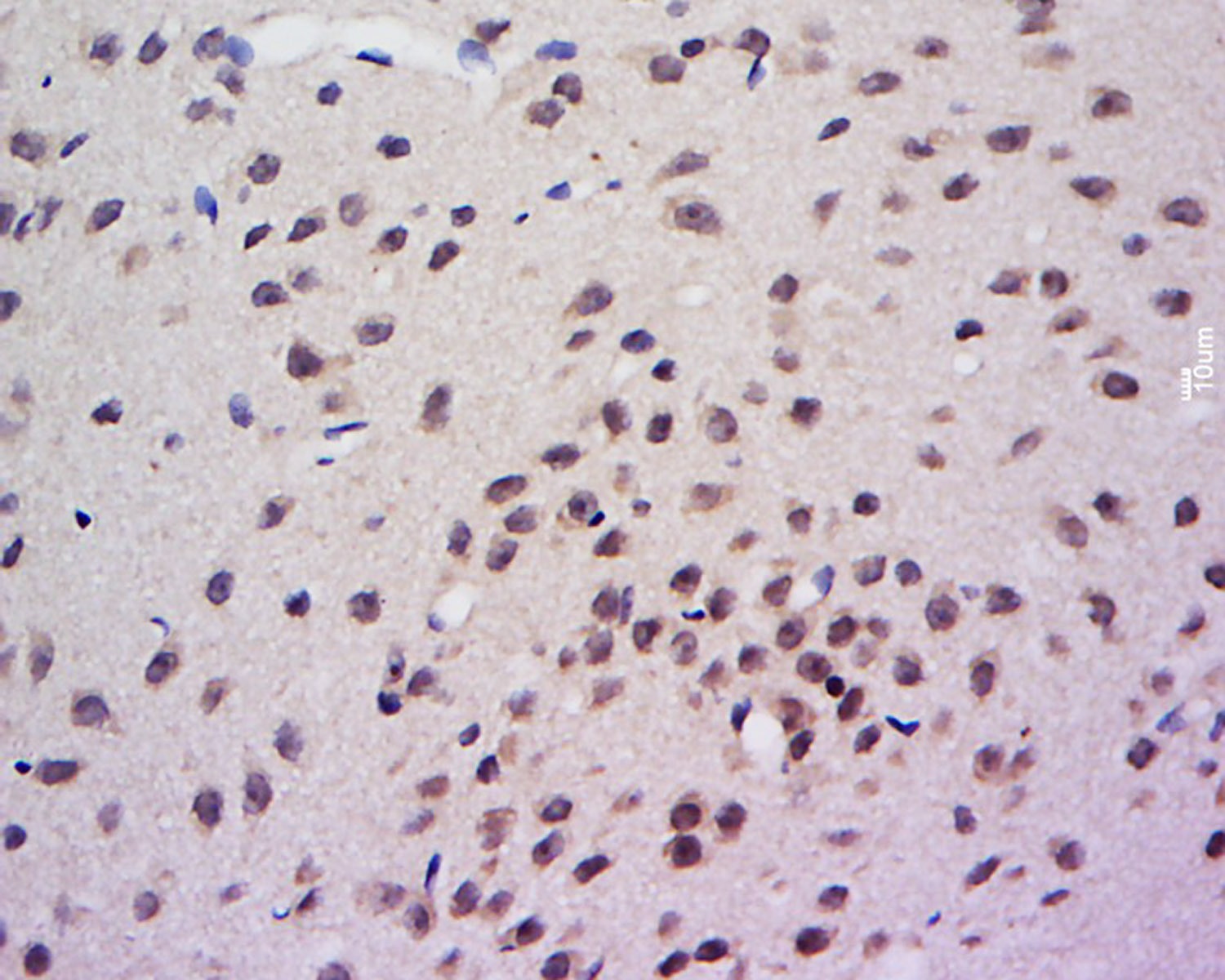 Anti-AHR Polyclonal Antibody