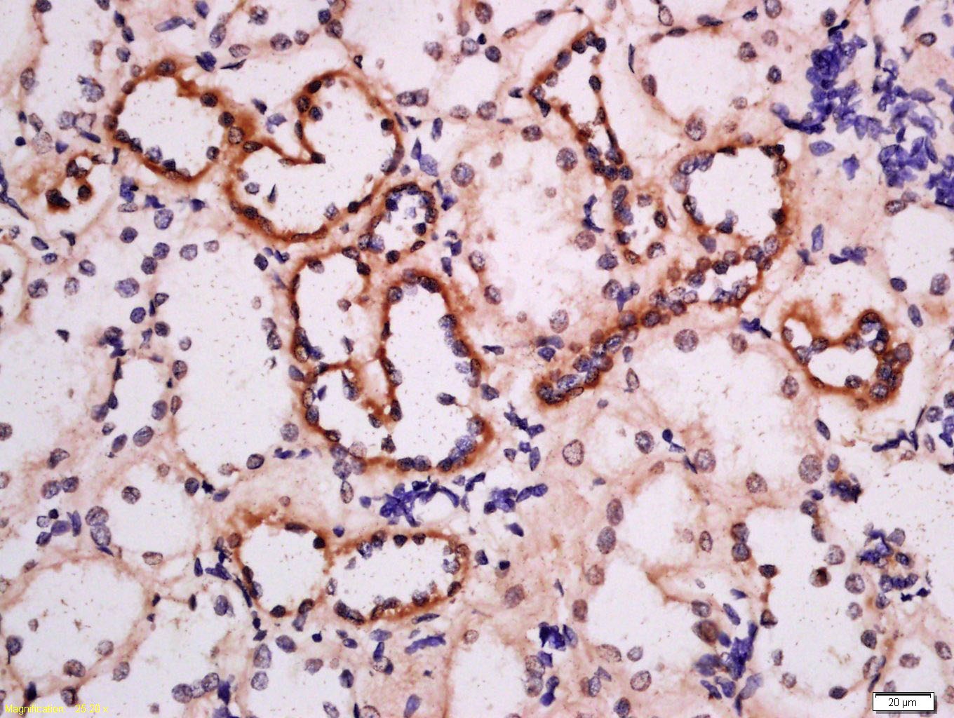 Anti-ADRB3 Polyclonal Antibody 2