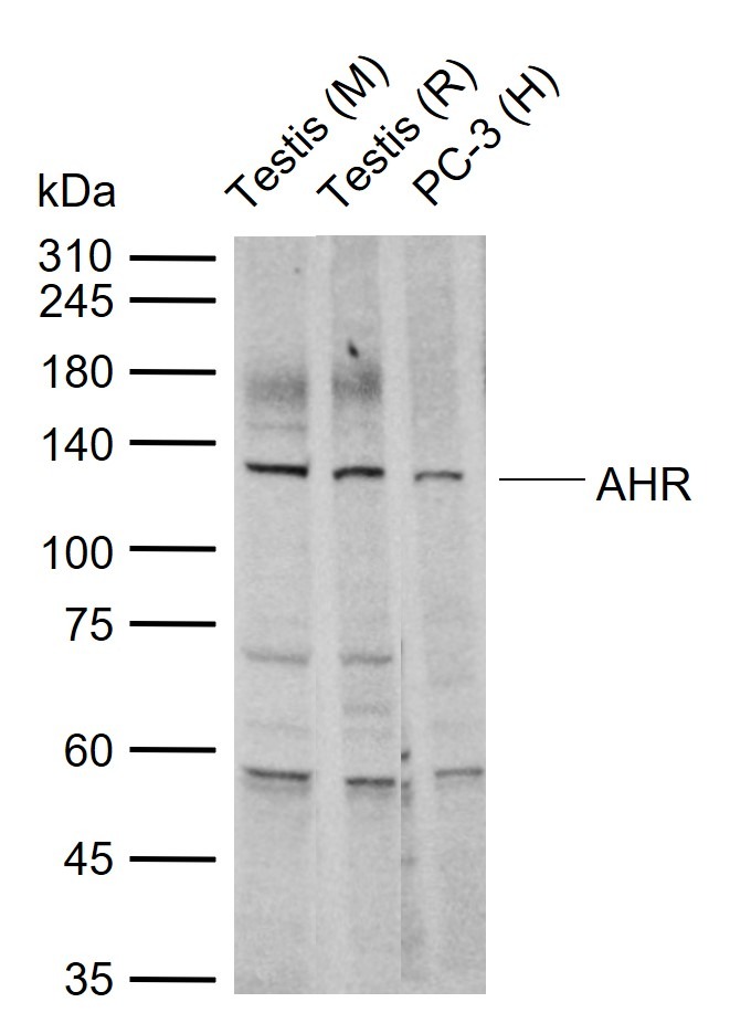 Anti-AHR Polyclonal Antibody 2