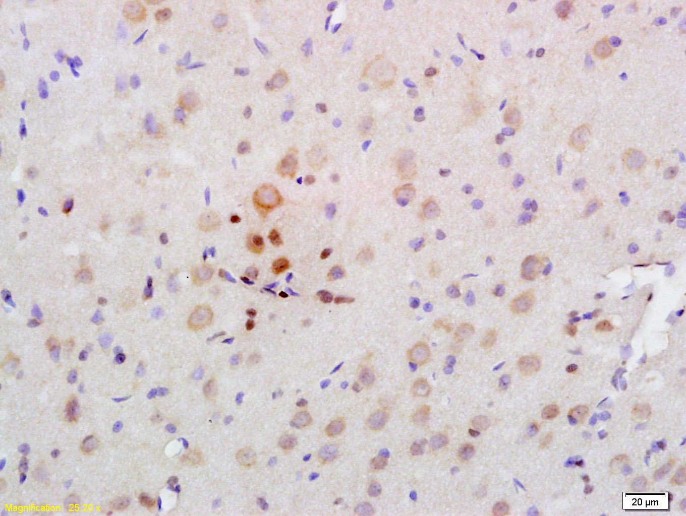 Anti-AMPK alpha 2 Polyclonal Antibody