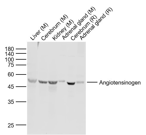 Anti-Angiotensin II Polyclonal Antibody