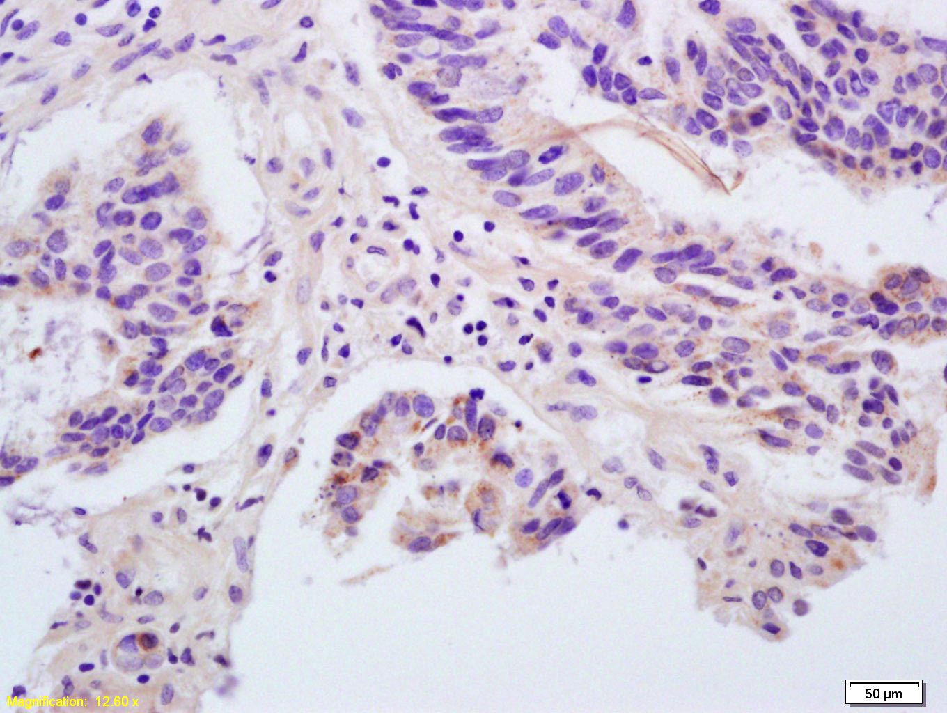 Anti-Angiopoietin-1 Polyclonal Antibody