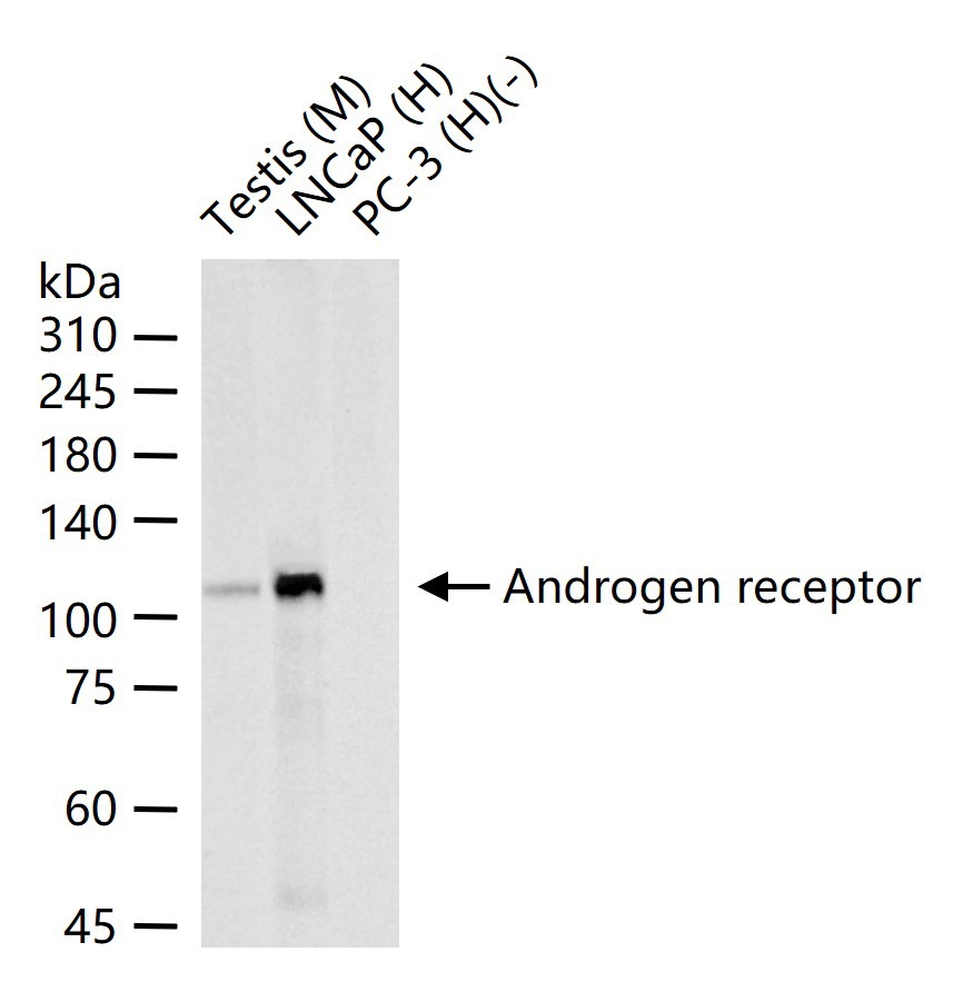 Anti-Androgen receptor Polyclonal Antibody