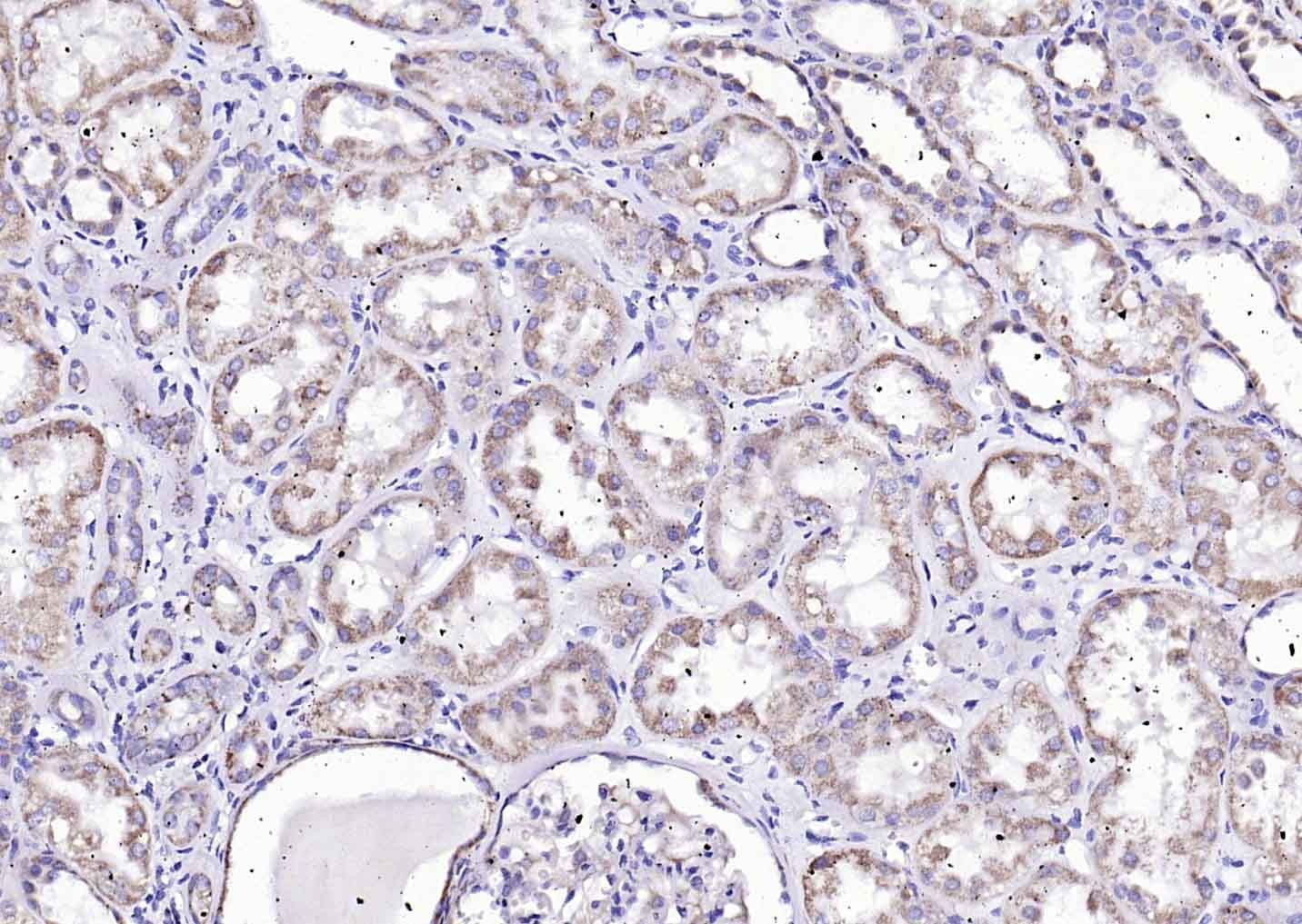 Anti-Angiopoietin-1 Polyclonal Antibody