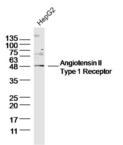 Anti-AGTR1 Polyclonal Antibody