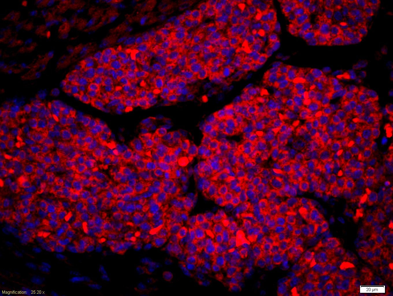 Anti-Amphiregulin Polyclonal Antibody
