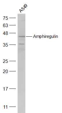 Anti-Amphiregulin Polyclonal Antibody