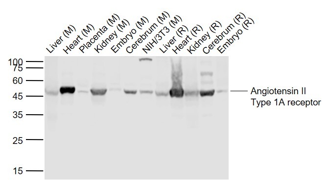 Anti-AGTR1 Polyclonal Antibody 2
