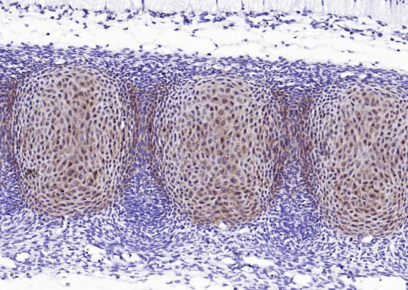 Anti-Aggrecan Polyclonal Antibody 2