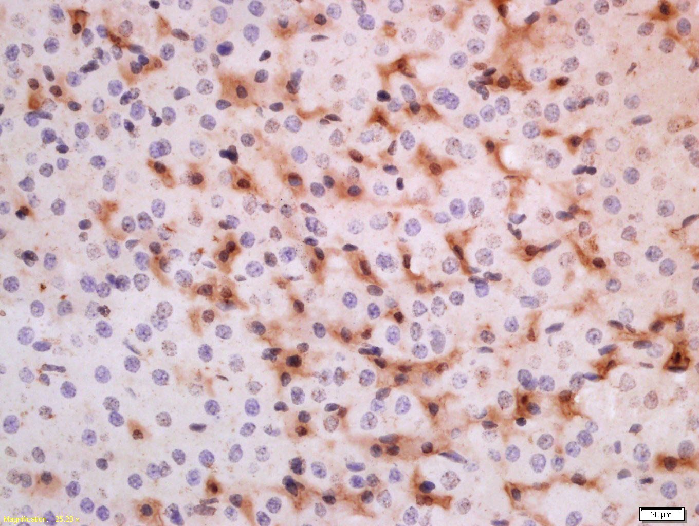 Anti-ADRB3 Polyclonal Antibody 2