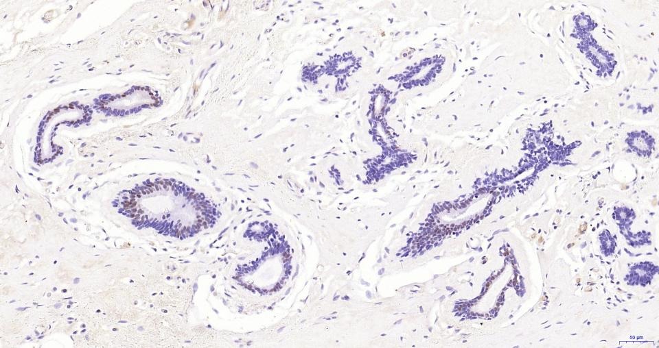 Anti-Androgen receptor Polyclonal Antibody