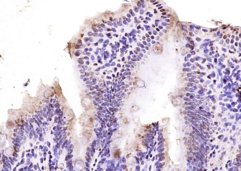 Anti-AHR Polyclonal Antibody 2