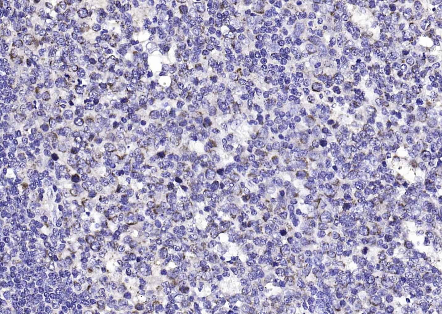 Anti-Amphiregulin Polyclonal Antibody