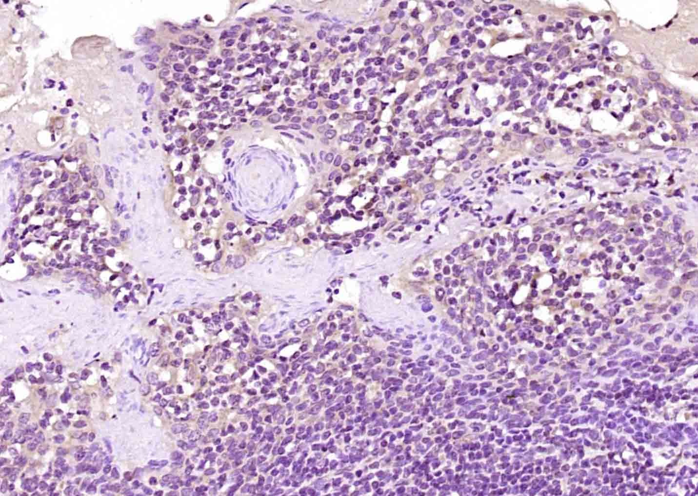 Anti-AIM2 Polyclonal Antibody