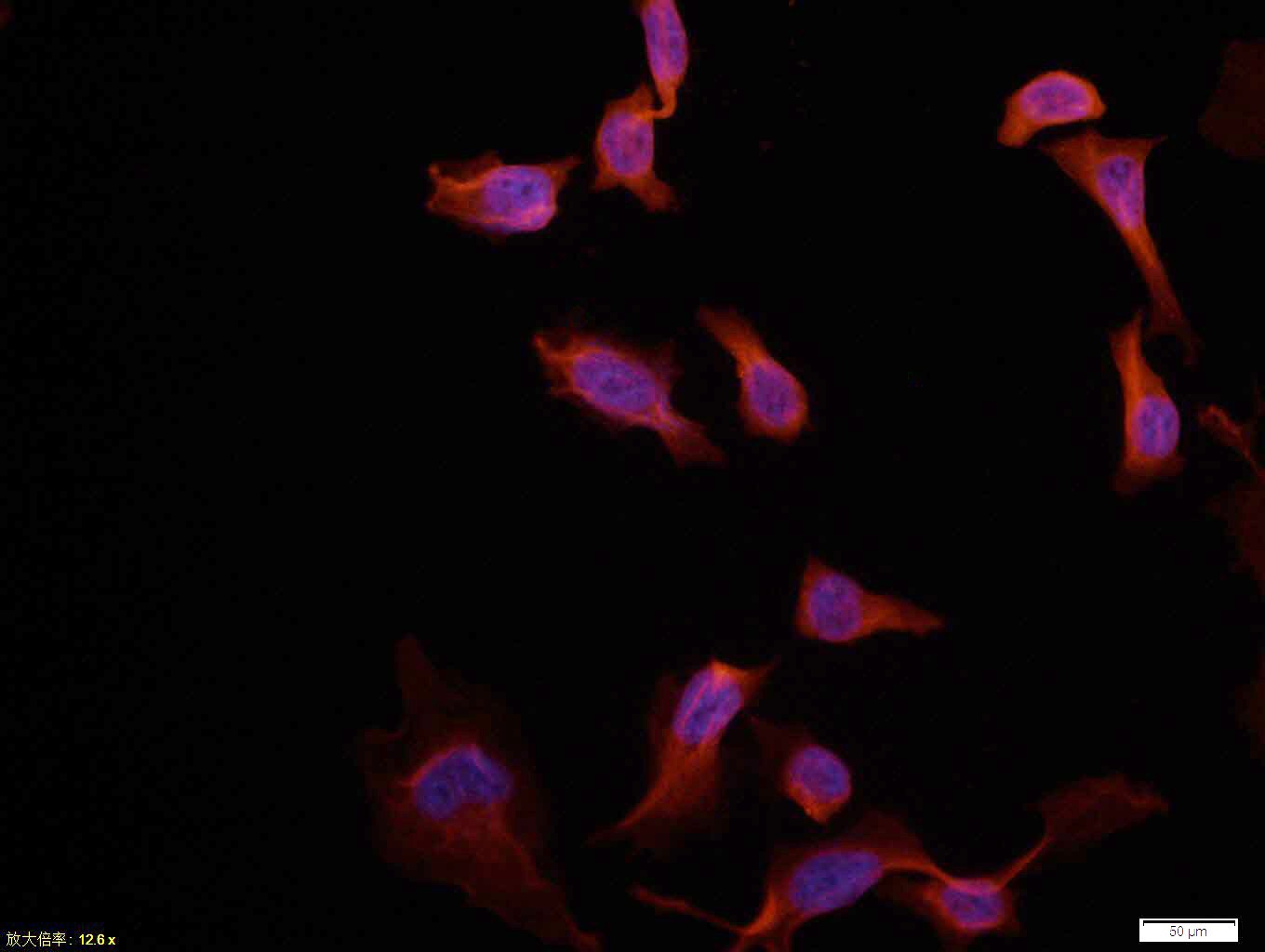 Anti-AKT1 Polyclonal Antibody