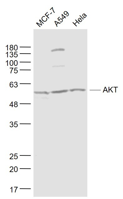 Anti-AKT1 Antibody (9A581)