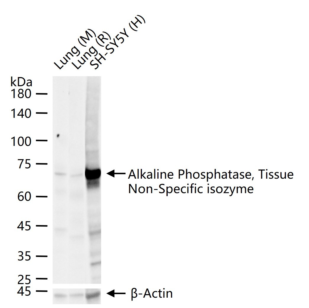 Anti-Alkaline Phosphatase/ALPL Polyclonal Antibody