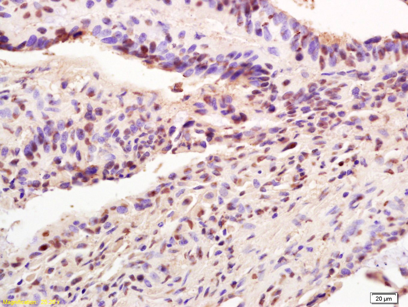 Anti-AIM2 Polyclonal Antibody