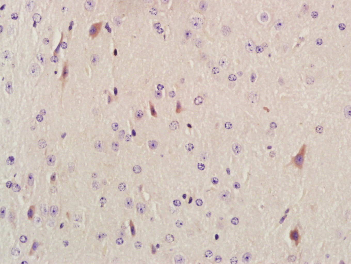 Anti-AKAP12 Polyclonal Antibody
