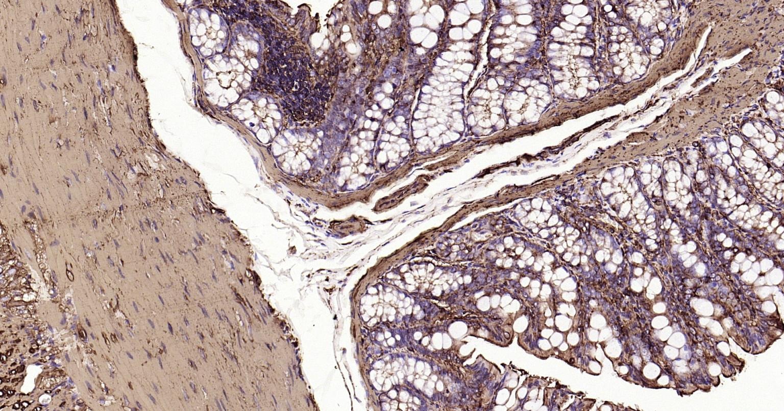 Anti-ACTA2 Antibody (1T673)