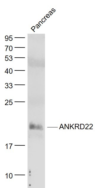 Anti-ANKRD22 Polyclonal Antibody