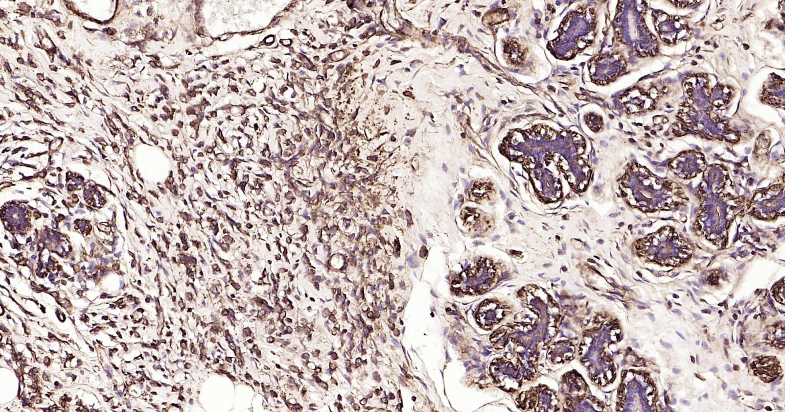 Anti-ACTA2 Antibody (1T673)