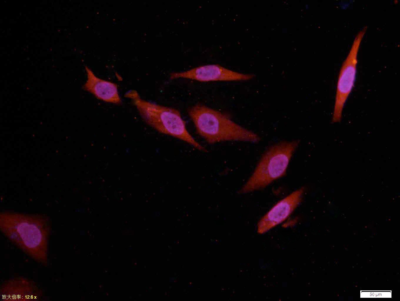 Anti-AKT1 Antibody (9A581)