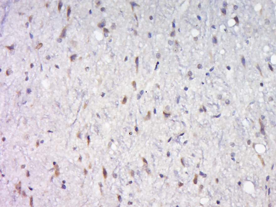 Anti-AKT1/2/3 Polyclonal Antibody