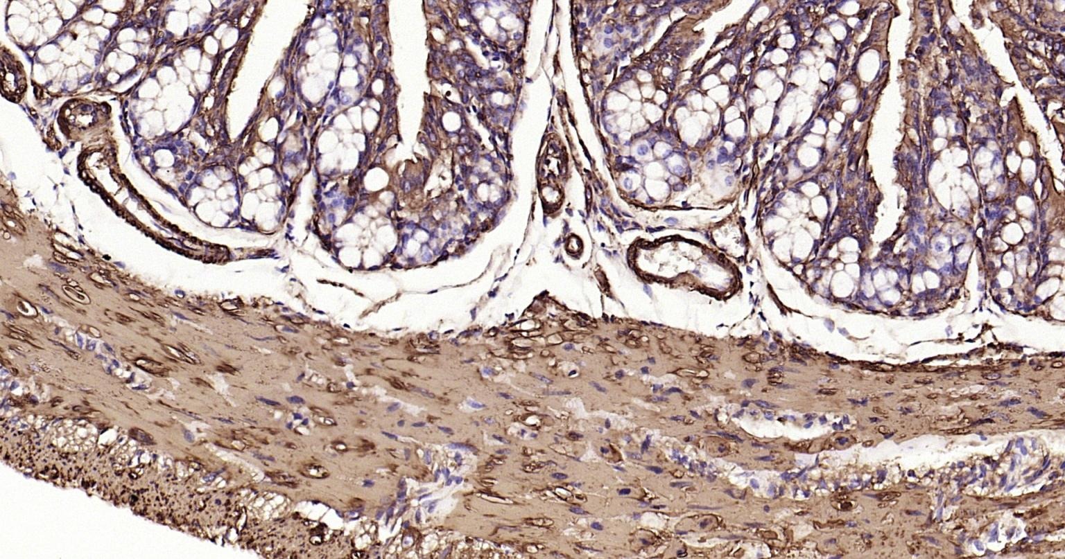 Anti-ACTA2 Antibody (1T673)