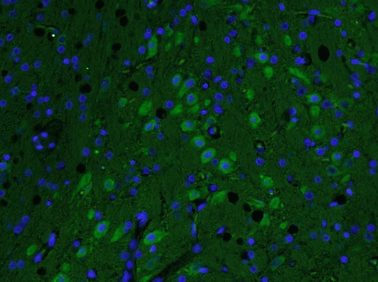 Anti-AKAP12 Polyclonal Antibody