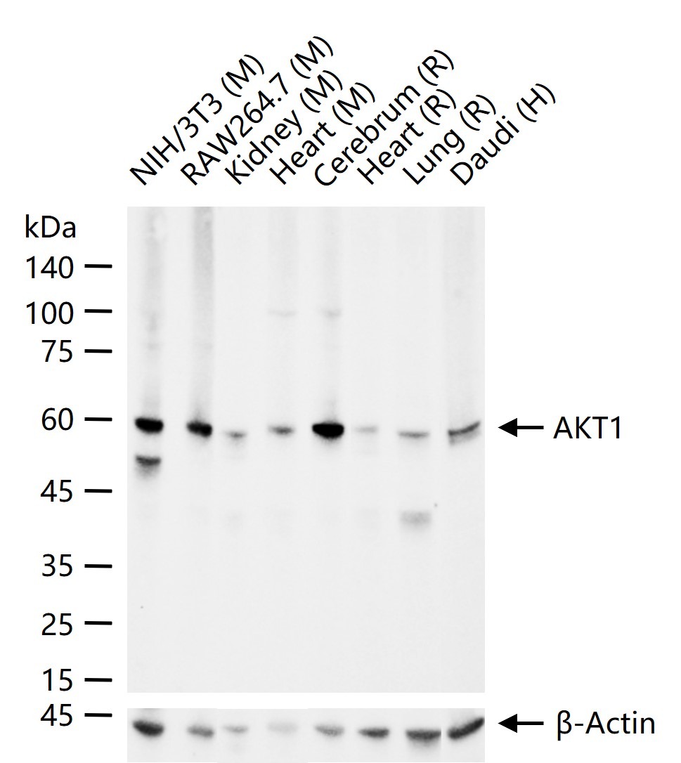 Anti-AKT1 Antibody (2U423)