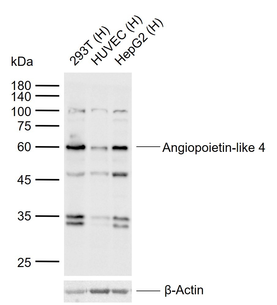 Anti-ANGPTL4 Polyclonal Antibody