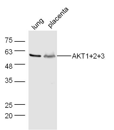 Anti-AKT1/2/3 Polyclonal Antibody