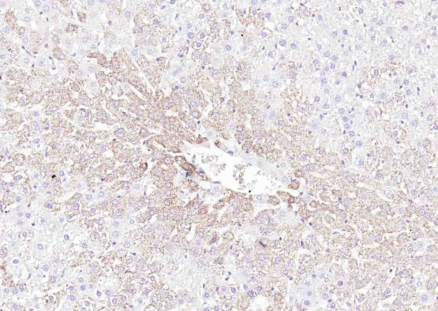 Anti-ANGPTL4 Polyclonal Antibody