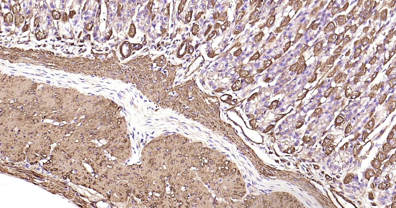 Anti-ACTA2 Antibody (1T673)