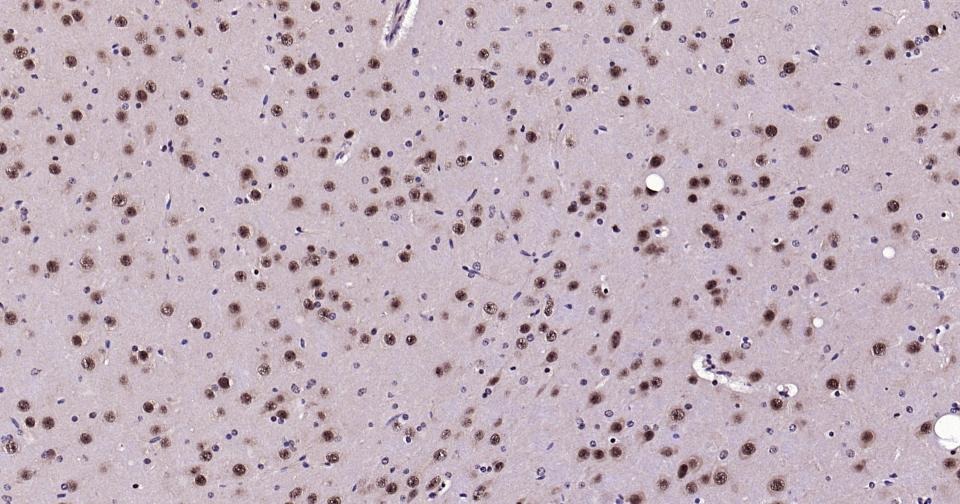 Anti-AKT1 Antibody (2U423)