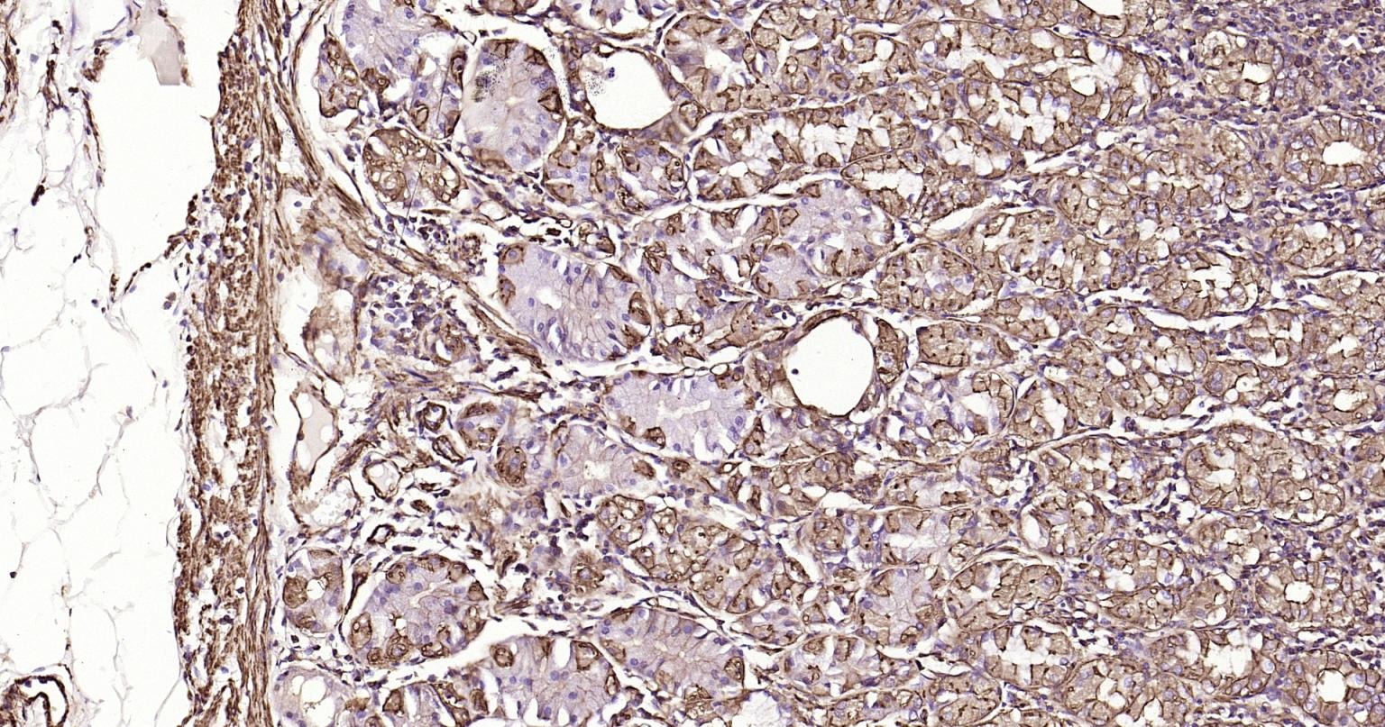 Anti-ACTA2 Antibody (1T673)