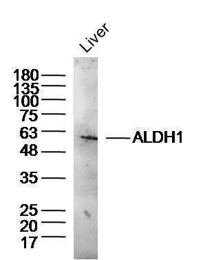 Anti-ALDH1A1 Polyclonal Antibody