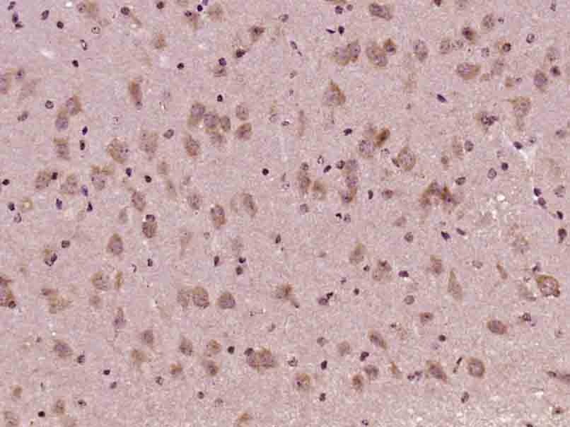 Anti-AKT1 Polyclonal Antibody