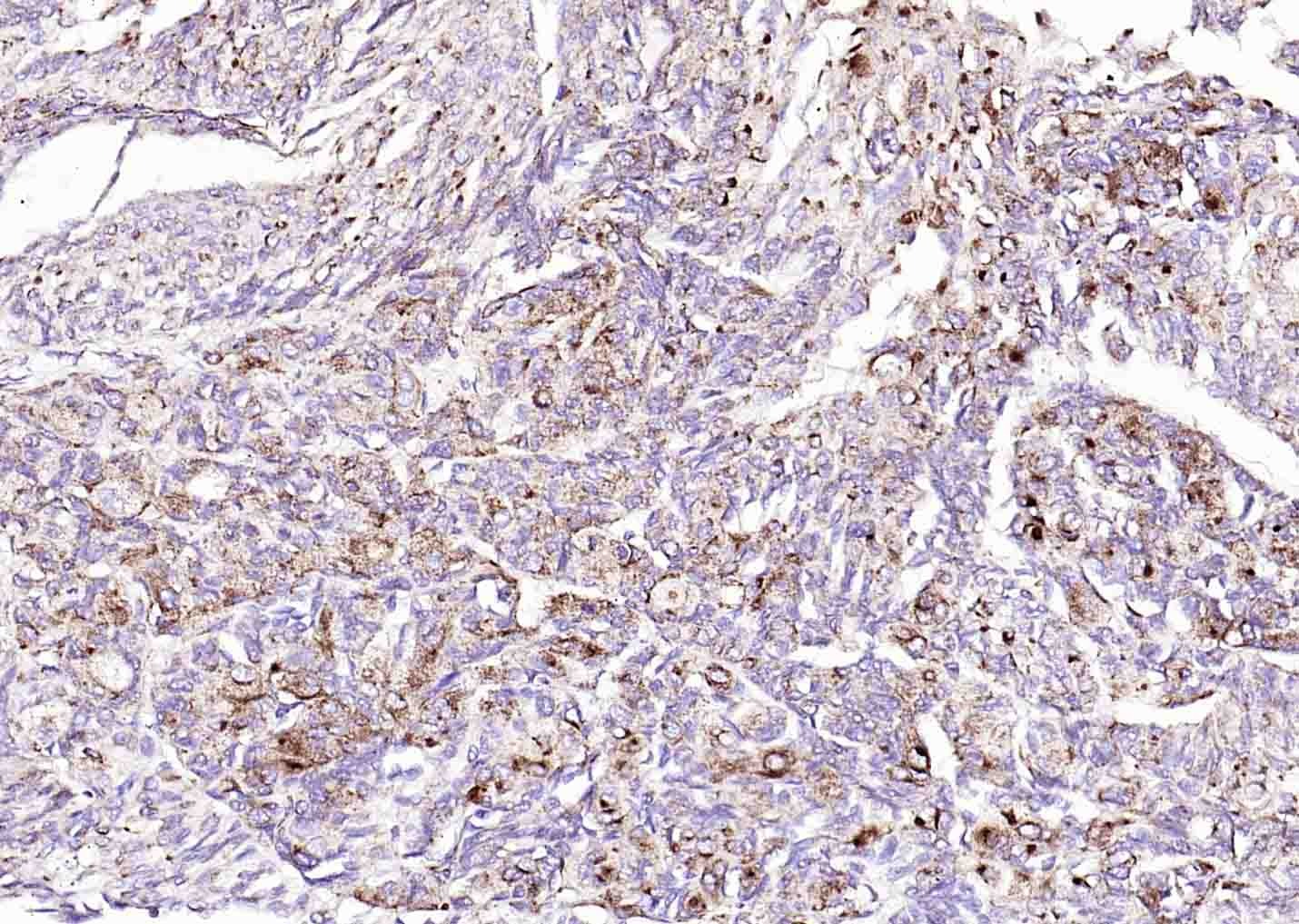 Anti-ANGPTL4 Polyclonal Antibody