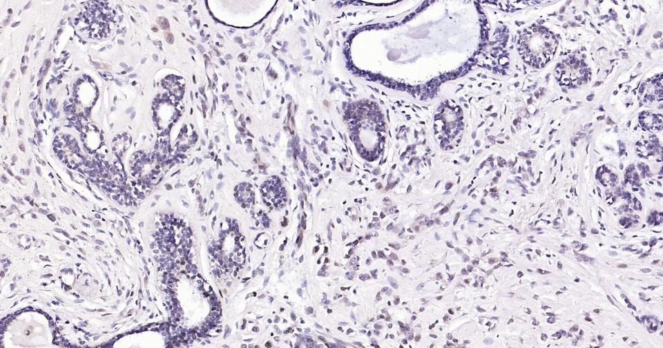 Anti-AKT1 Antibody (2U423)
