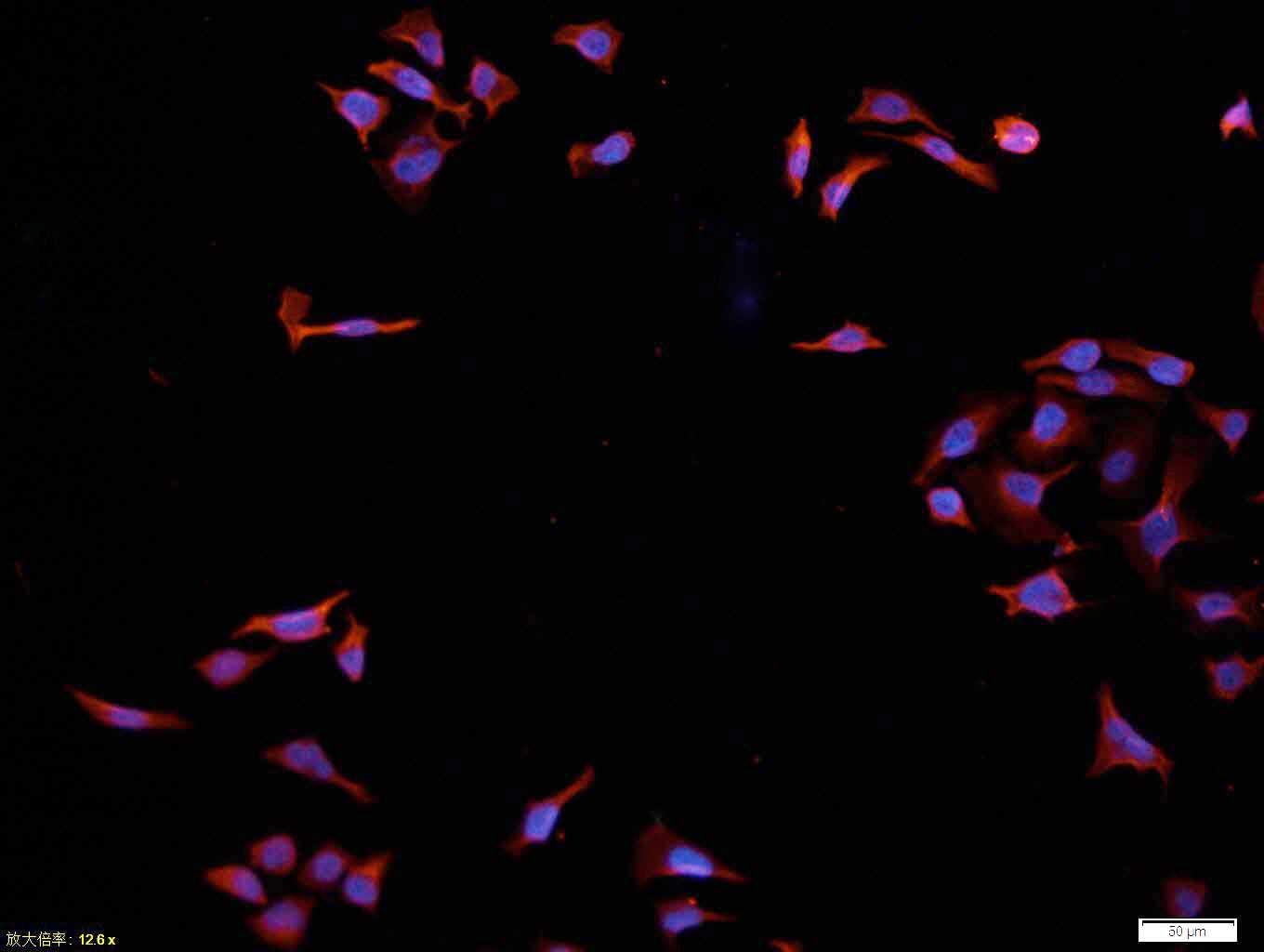 Anti-AKT1 Polyclonal Antibody