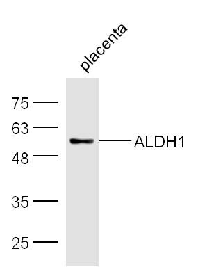 Anti-ALDH1A1 Polyclonal Antibody
