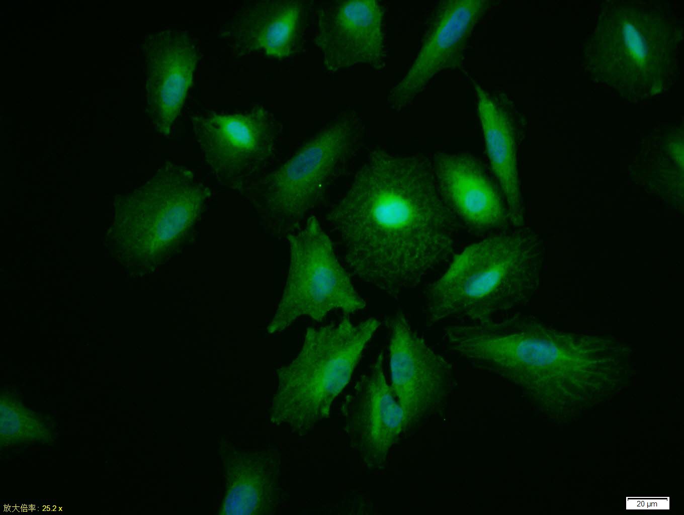 Anti-AKT1 Polyclonal Antibody 2