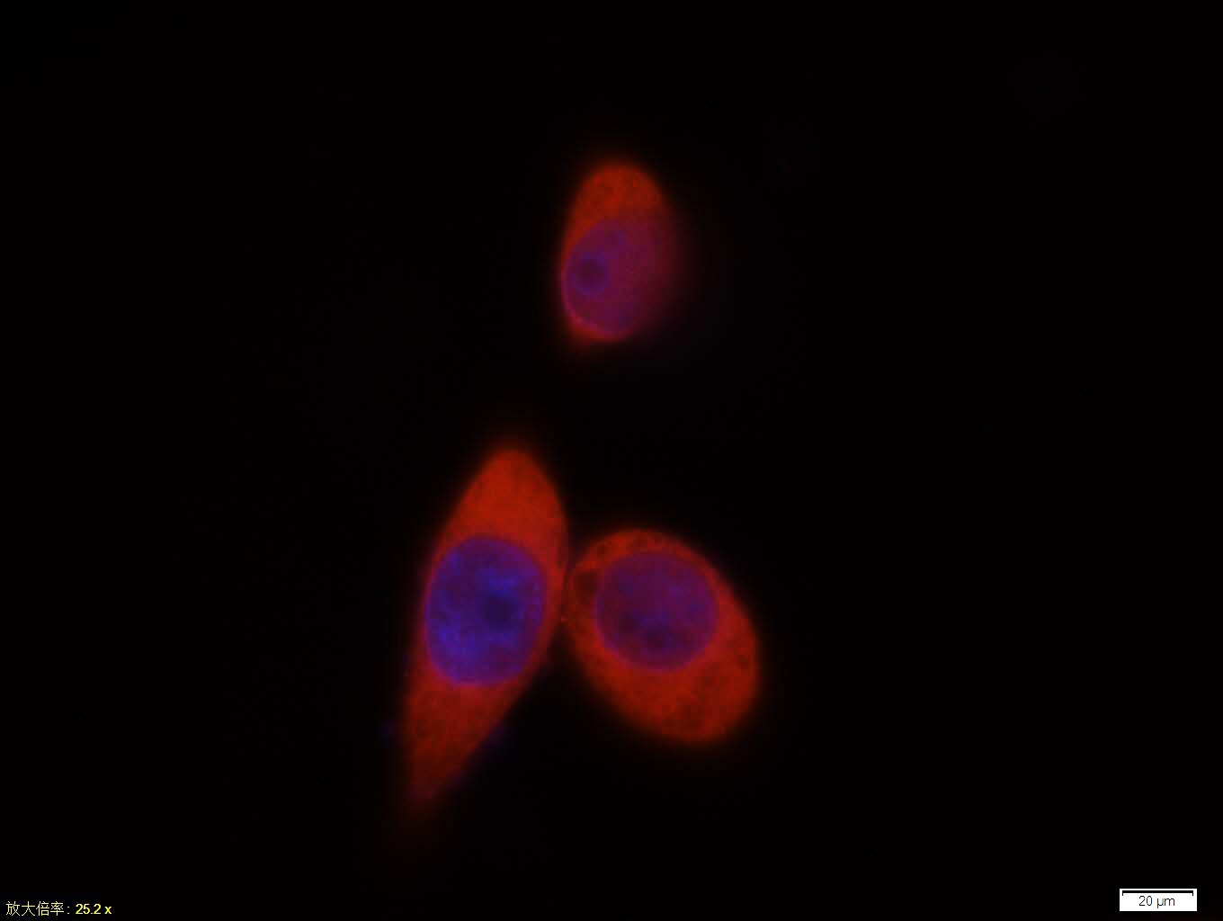 Anti-AKT1 Polyclonal Antibody