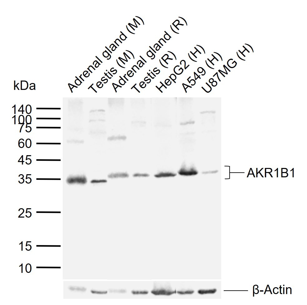 Anti-AKR1B1 Polyclonal Antibody