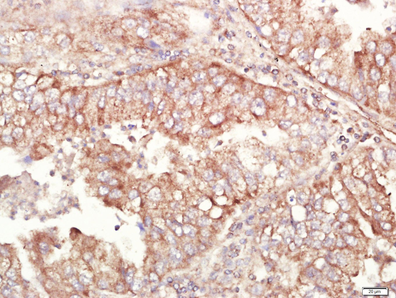 Anti-ALDH1A1 Polyclonal Antibody
