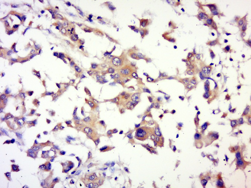 Anti-AKT1 Polyclonal Antibody
