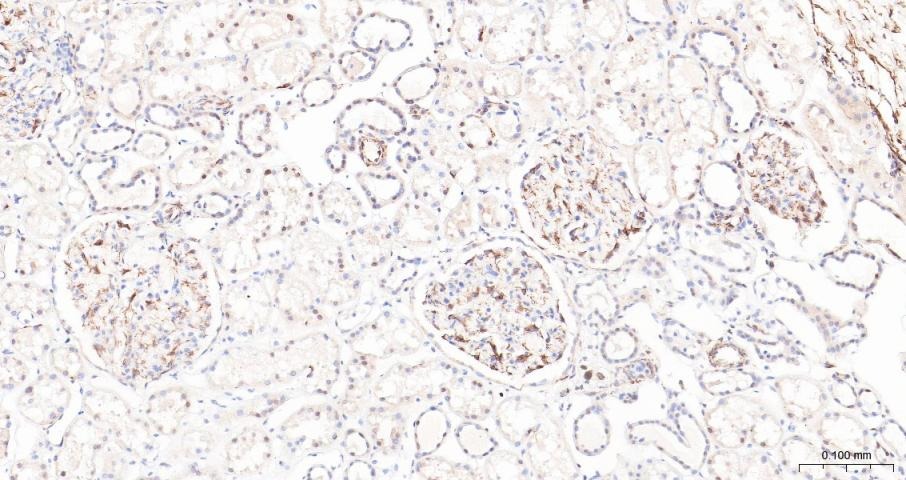 Anti-ADAM17 Polyclonal Antibody