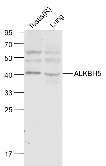 Anti-ALKBH5 Polyclonal Antibody